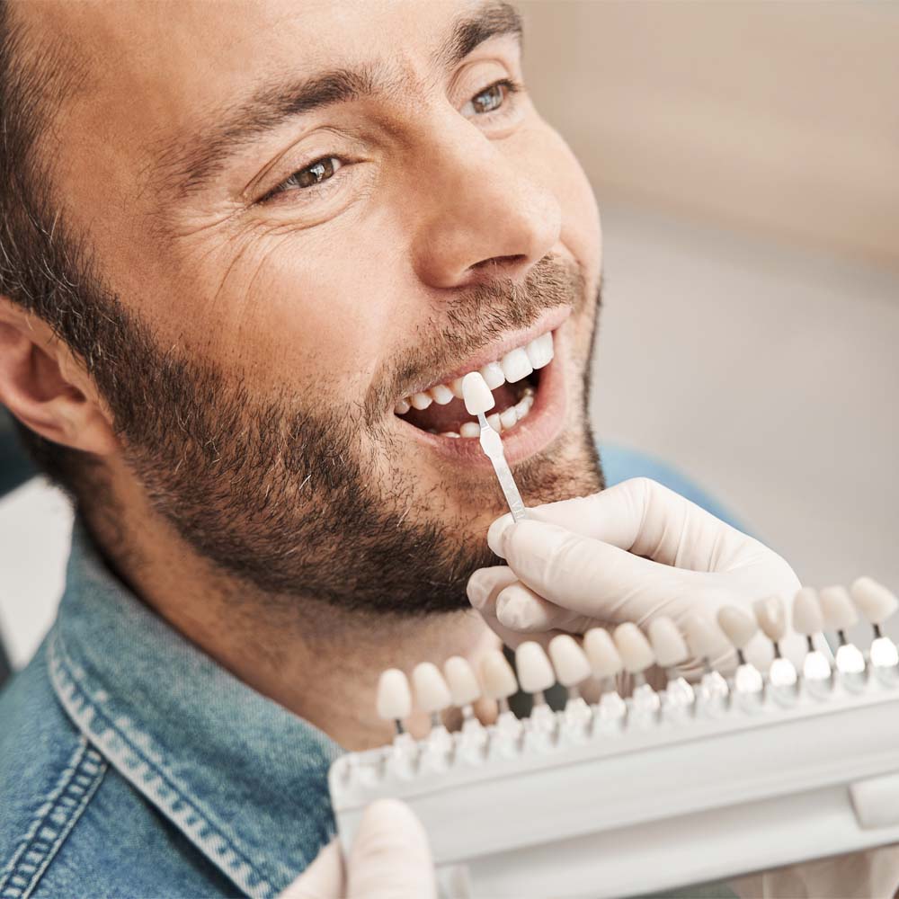 Mann bekommt verschiedenfarbige Micro-Veneers gezeigt