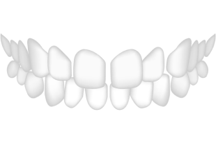 Zahnschema - Lückenstand