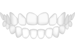 Zahnschema - Offener Biss